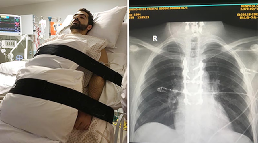 Imagem: DKVN Anvisa libera teste com remédio que pode recuperar os movimentos regenerando lesão medular Imagem: DKVN Anvisa libera teste com remédio que pode recuperar os movimentos regenerando lesão medular