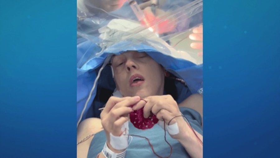 Imagem: Paciente fazendo croche Paciente faz crochê enquanto passa por cirurgia no cérebro para a retirada de tumor