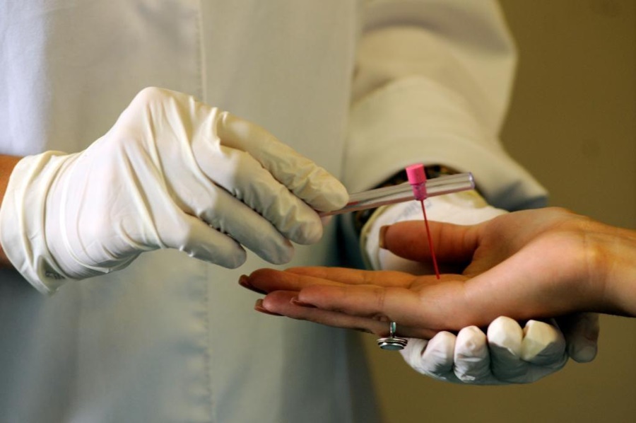 Imagem: Teste hansaniase Secretaria de Estado de Saúde de Mato Grosso reforça ações para enfrentar a hanseníase