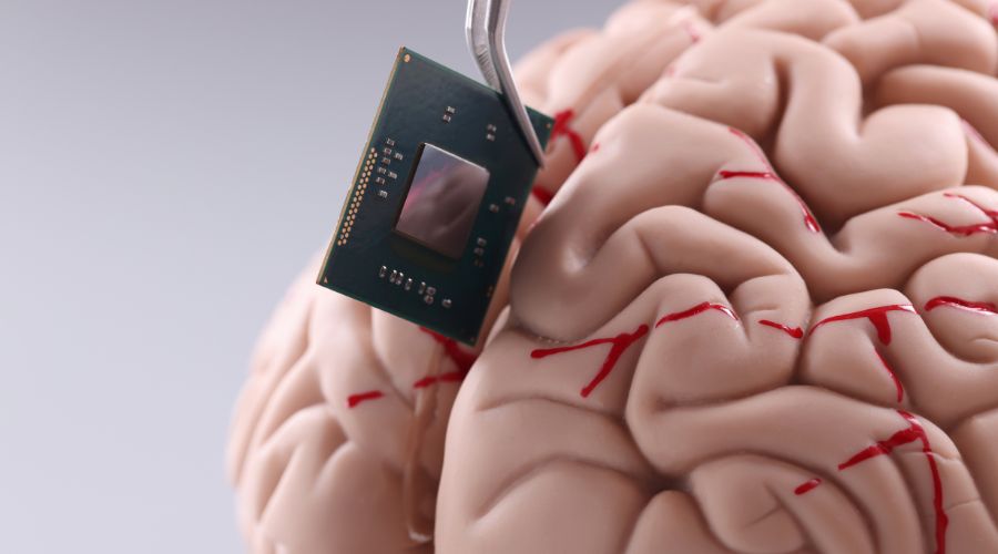 Imagem: VIDEO SITE 7 Elon Musk acelera produção de chips que conectam cérebro a computadores