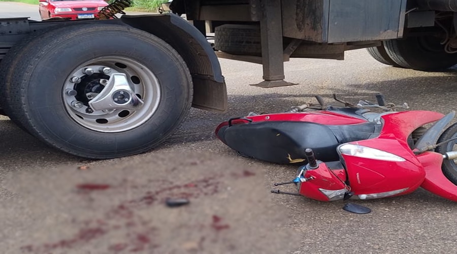 Imagem: adjv Jovem tem fratura exposta no braço após colisão entre moto e carreta no Distrito Industrial
