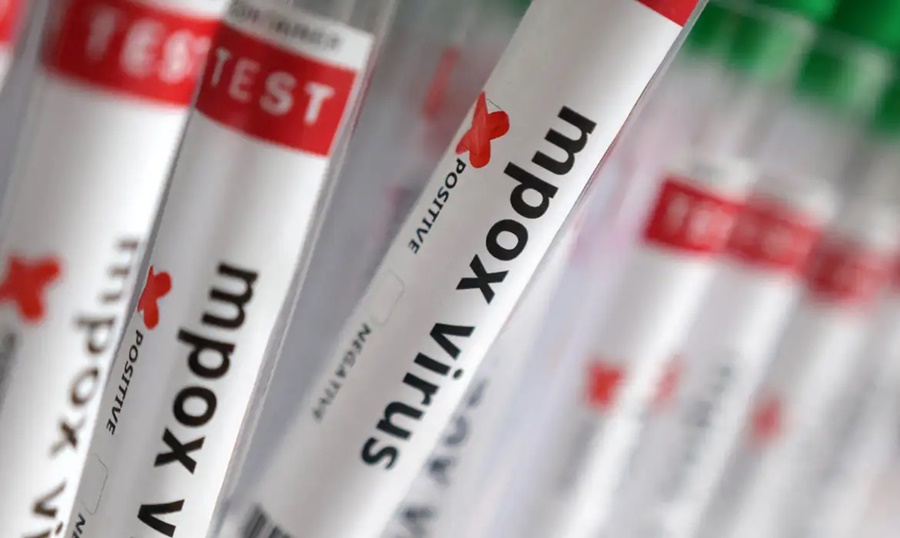 Imagem: Mpox virus Sobe para 140 número de casos confirmados de Mpox no país, em 2026 Imagem: Mpox virus Sobe para 140 número de casos confirmados de Mpox no país, em 2026