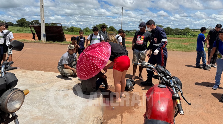 Imagem: WhatsApp Image 2026 03 20 at 14.23.43 Acidente entre duas motocicletas deixa dois condutores feridos no bairro Alfredo de Castro
