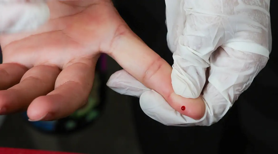 Imagem: akd SUS passa a oferecer teste rápido de dengue Imagem: akd SUS passa a oferecer teste rápido de dengue