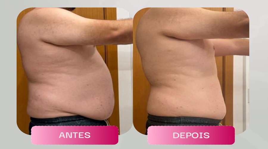 Imagem: ajdnv Clínica Gênesis se destaca em tratamentos estéticos e protocolos exclusivos em Rondonópolis