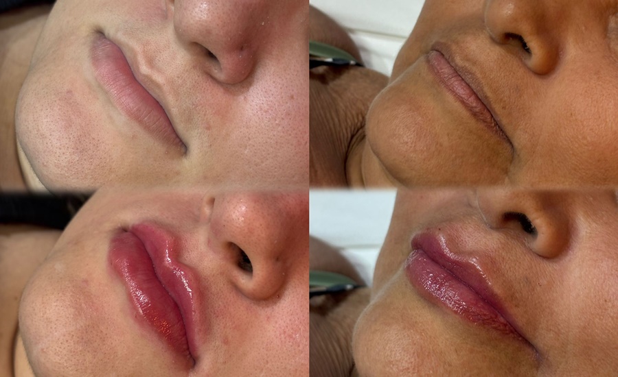 Imagem: ksv n Clínica Gênesis se destaca em tratamentos estéticos e protocolos exclusivos em Rondonópolis