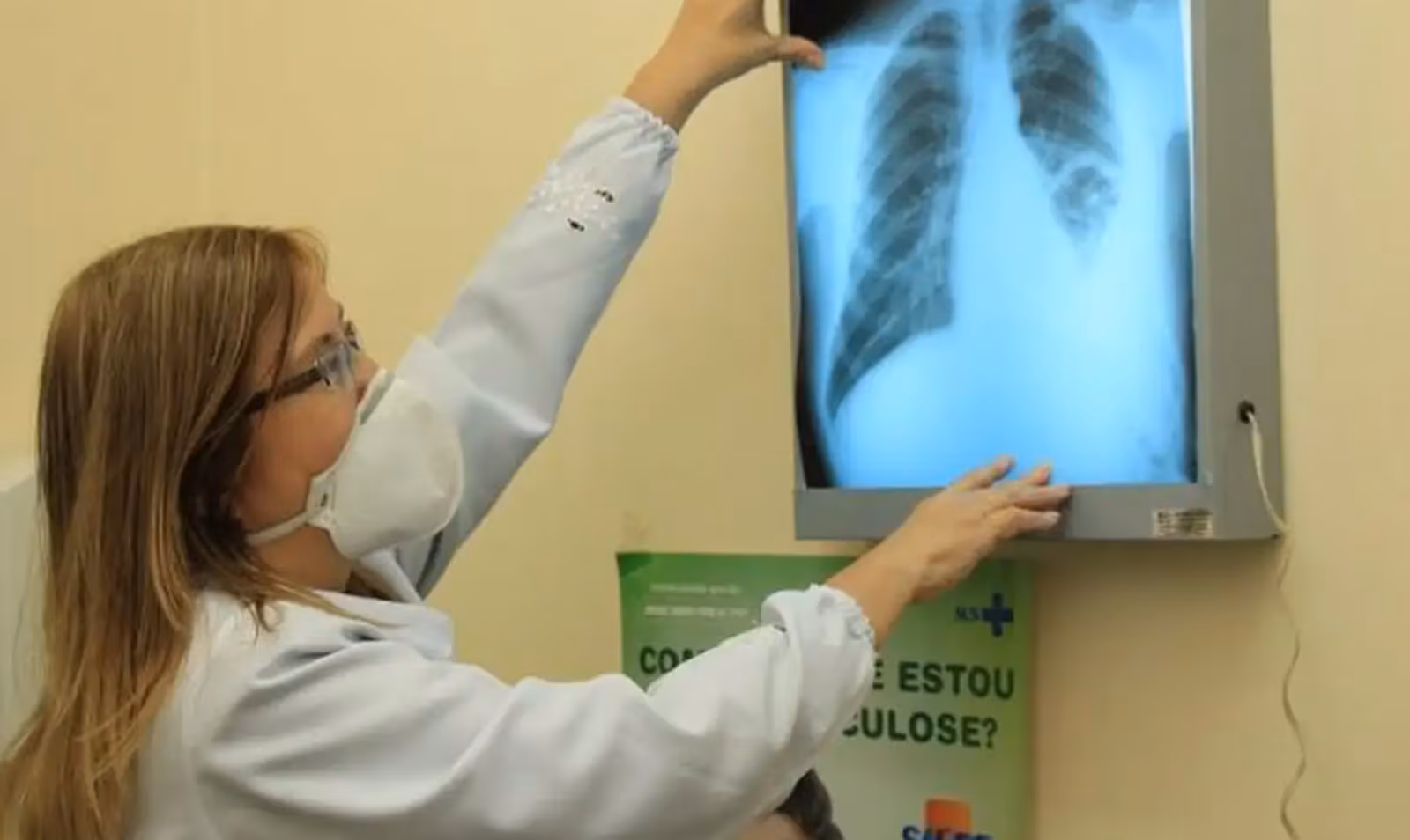 Imagem: QH5IOKXPVNFYHD4VPJFSU4IESQ Ministério da Saúde quer criar teste rápido para tuberculose; Brasil tem cerca de 80 mil casos por ano Imagem: QH5IOKXPVNFYHD4VPJFSU4IESQ Ministério da Saúde quer criar teste rápido para tuberculose; Brasil tem cerca de 80 mil casos por ano