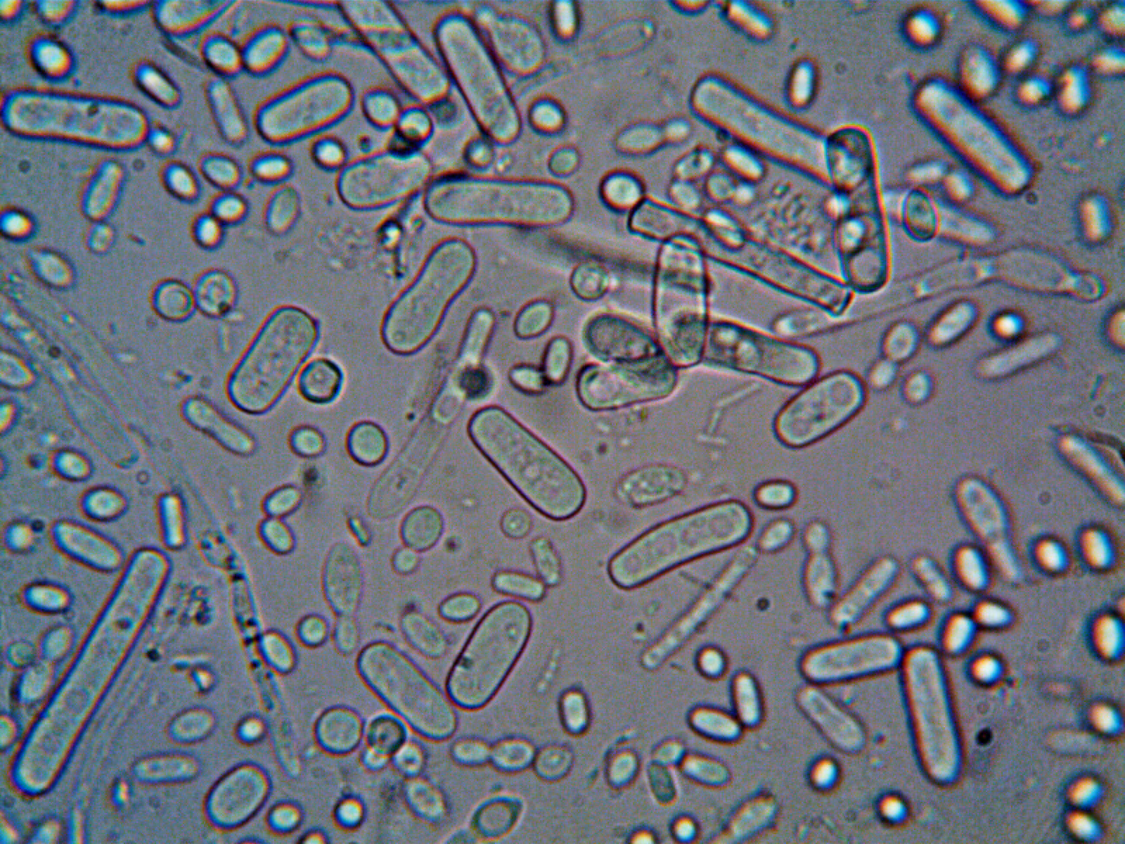 Imagem: YYMFFG44VZFO7ILOK2MORPYUBE Bactérias resistentes a remédios deixam crianças mais vulneráveis ​​a infecções comuns, diz estudo