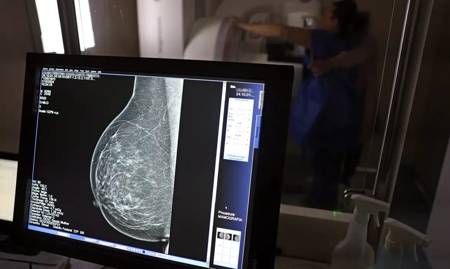 Imagem: Mamografia Mamografia digital passa a ter cobertura obrigatória pelos planos de saúde para todas as idades