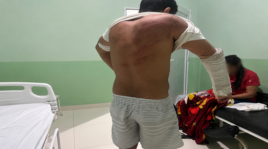 Imagem: apanhado 1 Polícia Civil prende dois suspeitos de tortura e sequestro após vítima ser retirada de casa e brutalmente agredida
