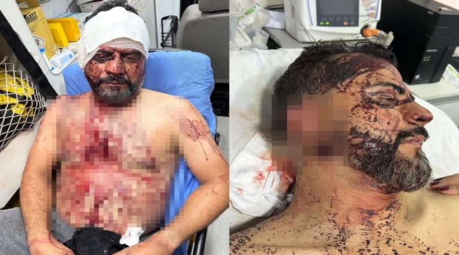 Imagem: wesley orelha cortada Ensanguentado e com orelha cortada: imagens mostram vereador no hospital após assalto em Rondonópolis Imagem: wesley orelha cortada Ensanguentado e com orelha cortada: imagens mostram vereador no hospital após assalto em Rondonópolis