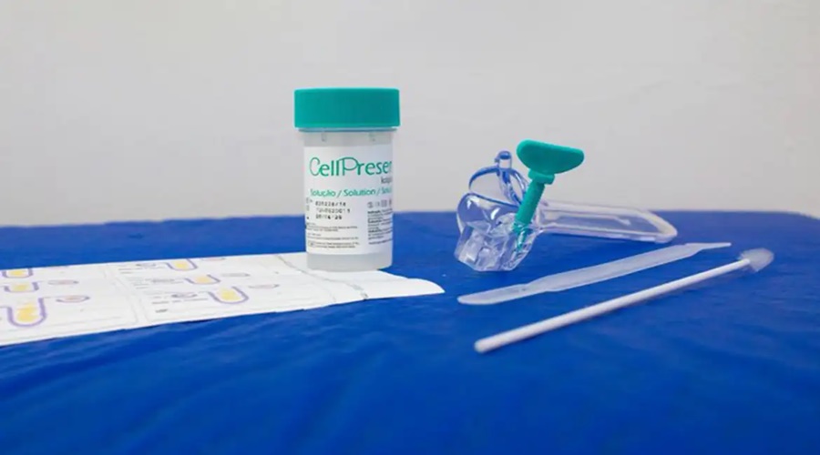 Imagem: teste hpv Exame de DNA-HPV já é utilizado em 26 estados e identifica casos de alto risco Imagem: teste hpv Exame de DNA-HPV já é utilizado em 26 estados e identifica casos de alto risco